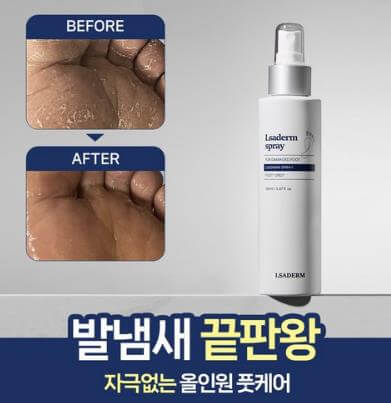 효과좋은 무좀약